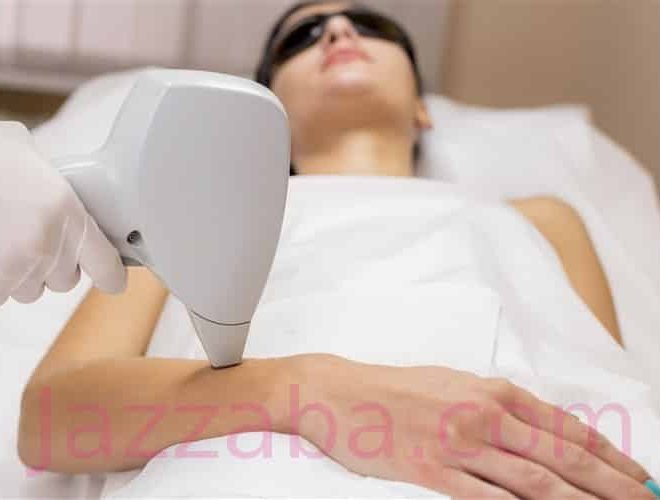 إزالة الشعر بالليزر بشكل نهائي من الجسم